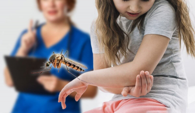 Ребенка покусали насекомые: что делать и когда обращаться в больницу?