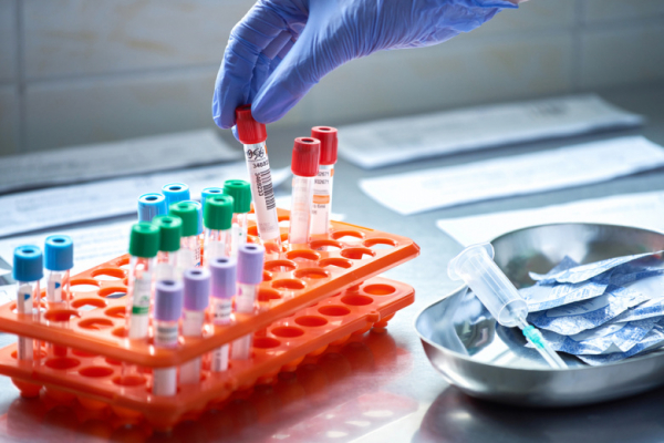 Врач объяснила, через какое время после укуса клеща надо сдать анализы